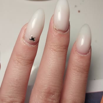 Tırnak Uygulaması Sonrası Sağlık Sorunu Ve Yetersiz Telafi