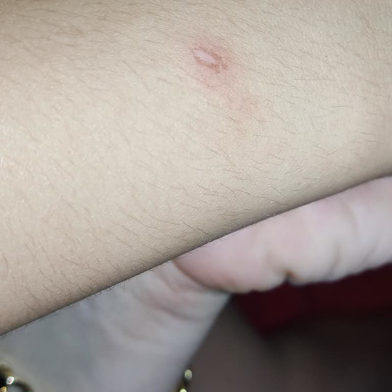 Çocuğumun Kullandığı Akıllı Saatte Güvenlik Sorunu Ve Yanma Hissi Yaşadık