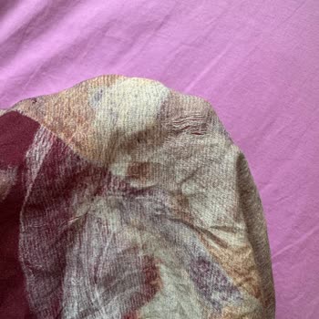 Aldığım Elbise İkinci Kullanımda Parçalandı, Satıcı İlgisiz