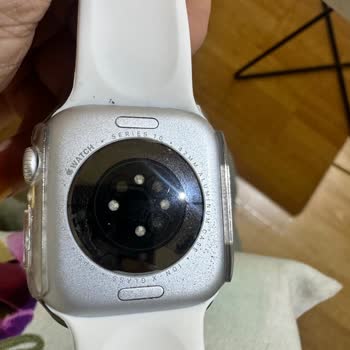 Apple Watch'ta Kronik Sorun Ve Yetersiz Destek Süreci