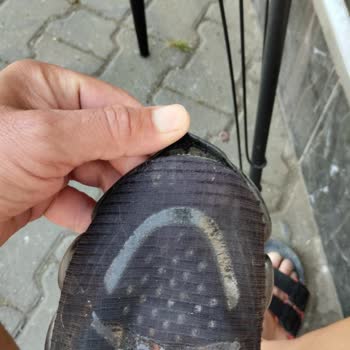 Aldığım Ayakkabıların Tabanı Kısa Sürede Tamamen Açıldı