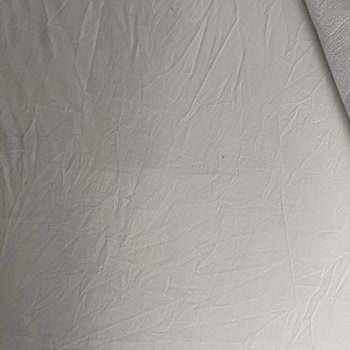 Otel Odasında Temizlik Ve Hizmet Sorunları Yaşadık