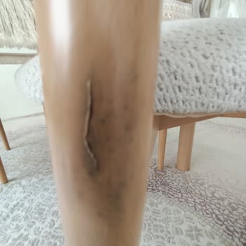 Çeyiz Takımında Hasar Ve İlgisiz Servis Deneyimi