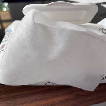 Küflü Bebek Havlusu Ve Islak Mendil Sağlığı Tehdit Ediyor