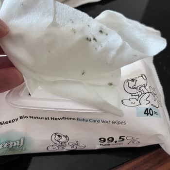 Küflü Bebek Havlusu Ve Islak Mendil Sağlığı Tehdit Ediyor