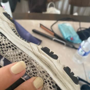 Skechers Ayakkabım 1 Yılda Yırtıldı, Garanti Desteği Sağlanmadı