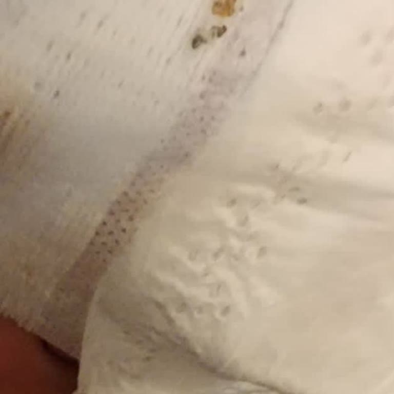 Bebek Bezinde Böcek Ve Kelebek Şoku!