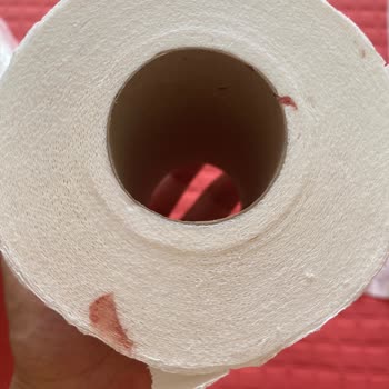 Solo Tuvalet Kağıdında Hijyen Endişesi Yaratan Lekeler!