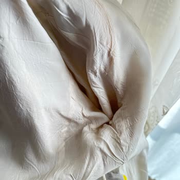 Kuru Temizleme Sonrası Ceketin Zarar Görmesi Ve Müşteri Hizmetlerinde İlgisizlik