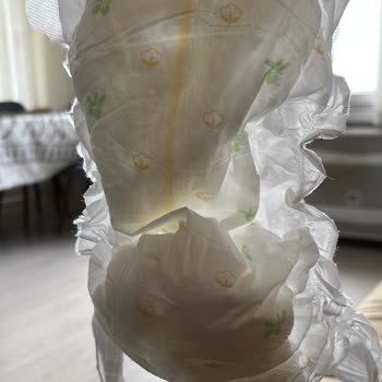 Kısa Sürede Kalitesizleşen Bebek Bezi Ve Rahatsızlık Sorunu