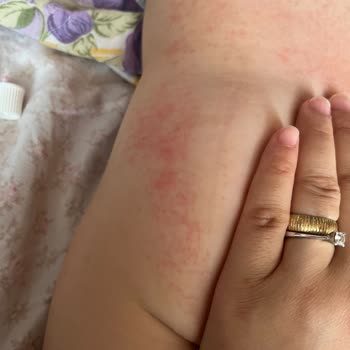 Kısa Sürede Kalitesizleşen Bebek Bezi Ve Rahatsızlık Sorunu