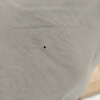 Profilo Çamaşır Makinesi Sorunu Çözülemiyor, Servis Yetersiz