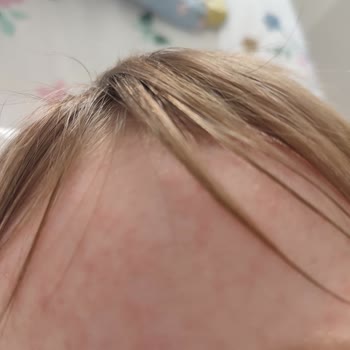 Mustela Şampuan Ve Kremi Bebeğimde Kızarıklık Ve Faydasızlık Yarattı