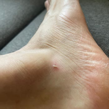 Ayakkabı Sorunu Ve İade Talebine Olumsuz Yanıt: Müşteri Hizmetlerine Ulaşılamıyor