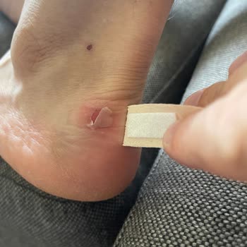 Ayakkabı Sorunu Ve İade Talebine Olumsuz Yanıt: Müşteri Hizmetlerine Ulaşılamıyor