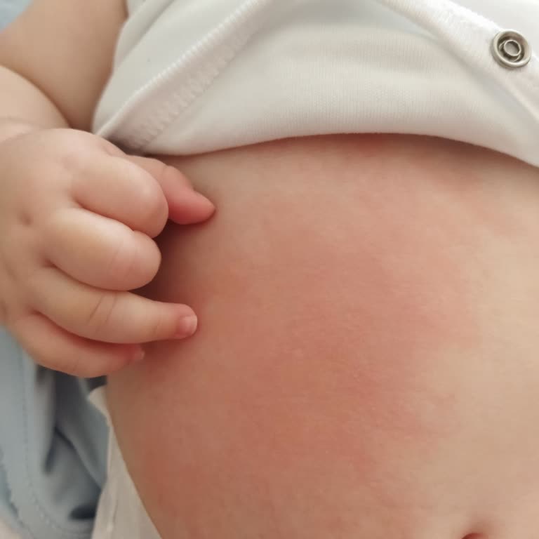 I Used Bioderma Atoderm Cream on My Baby and It Severely Irritated Their Skin