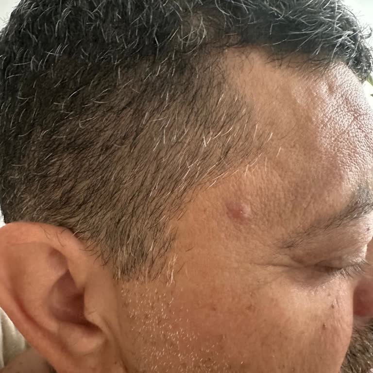 Fiyat Bilgisi Verilmeden Yapılan Küçük Operasyon Sonrası Beklenmedik Yüksek Ücret Talebi