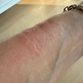 Guess Marka Saatte Alerji Ve Orijinallik Şüphesi