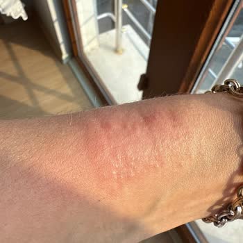 Guess Marka Saatte Alerji Ve Orijinallik Şüphesi