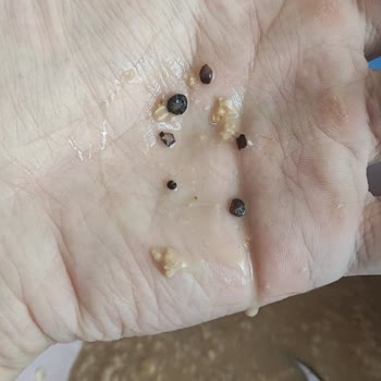 Yulaf Ezmesinden Çıkan Sert Siyah Maddeler Dişimi Kırabilirdi