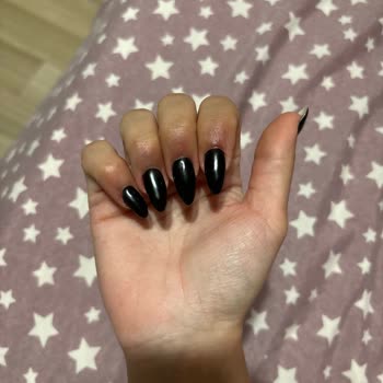 Manikür Sonrası Ciddi Yanık Ve İlgisiz Yaklaşım