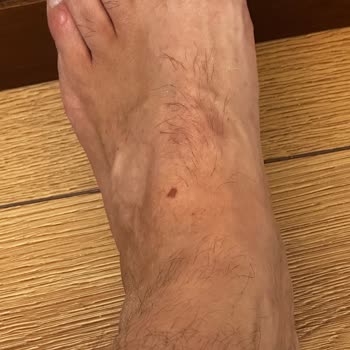 Beymen Club Terlik İlk Kullanımda Ayaklarımı Yaraladı