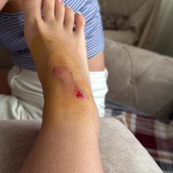 Acil Serviste İlgisizlik Ve İhmal Nedeniyle Mağduriyet Yaşadım