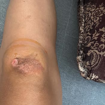 Acil Serviste İlgisizlik Ve İhmal Nedeniyle Mağduriyet Yaşadım