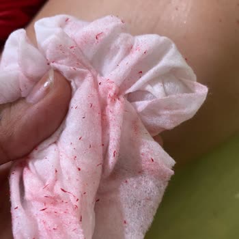 Aldığım Çocuk Şort Takımında Boya Sorunu Ve Sağlık Endişesi