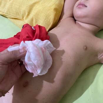 Aldığım Çocuk Şort Takımında Boya Sorunu Ve Sağlık Endişesi