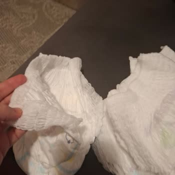 Aldığım Molfix 4 Numara Külot Bezde Yırtık Sorunu Ve Mağduriyet