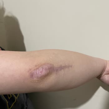 Axa Sigorta Tazminatımı Ödemiyor, Sürekli Oyalıyor