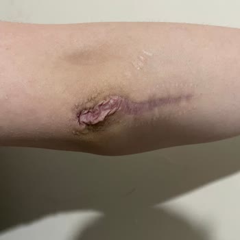 Axa Sigorta Tazminatımı Ödemiyor, Sürekli Oyalıyor