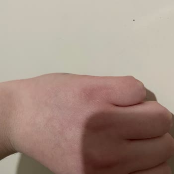 Axa Sigorta Tazminatımı Ödemiyor, Sürekli Oyalıyor