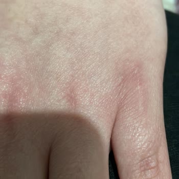 Axa Sigorta Tazminatımı Ödemiyor, Sürekli Oyalıyor