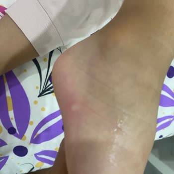 Sinek İlacı Etkisiz Kaldı Çocuğum Sineklerden Rahatsız Oldu