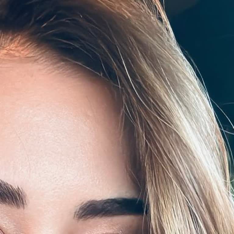 Aylin Çetinkaya Kalıcı Kaş Uygulaması Sonrası Memnuniyetsizlik Ve Zorlayıcı Süreç