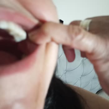 Üçkuyular Ağız Ve Diş Sağlığı Polikliniği İmplant Mağduriyeti