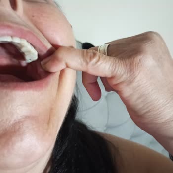 Üçkuyular Ağız Ve Diş Sağlığı Polikliniği İmplant Mağduriyeti