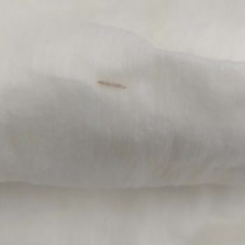 Bebek Bezi İçinde Ağaç Kıymığı: Güvenlik Endişesi