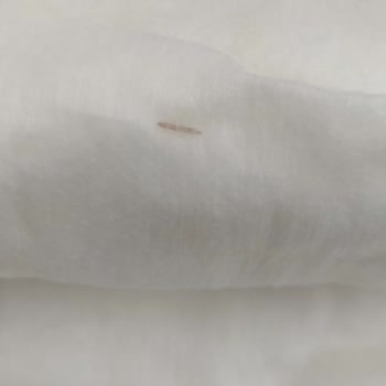 Bebek Bezi İçinde Ağaç Kıymığı: Güvenlik Endişesi