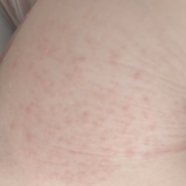 Bebem Naturel 5 Numara Bezde Koku Ve Tahriş Sorunu Yaşadım