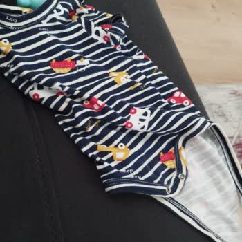 Bebek Kıyafetinde Boya Akması Nedeniyle Sağlıksız Ürün Endişesi