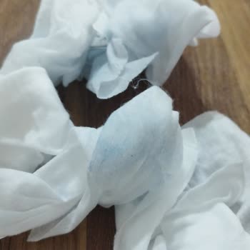 Bebek Kıyafetinde Boya Akması Nedeniyle Sağlıksız Ürün Endişesi