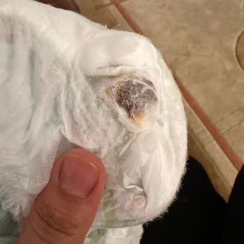 Bebek Bezinde Yabancı Madde Endişesi