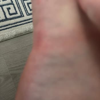 Kısa Sürede Ayağımı Yaralayan Pahalı Terlik İçin Olumsuz İnceleme Ve İade Sorunu