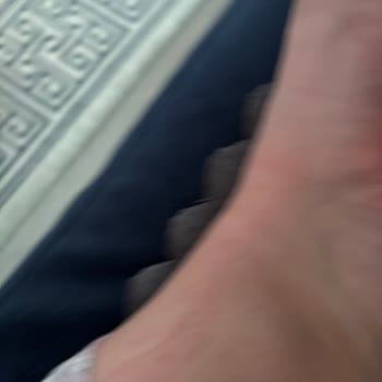 Kısa Sürede Ayağımı Yaralayan Pahalı Terlik İçin Olumsuz İnceleme Ve İade Sorunu