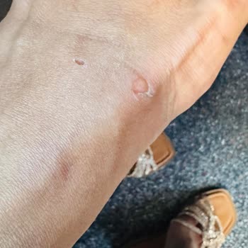 İlk Kullanımda Ayağımı Yaralayan Terlikler Tatilimi Mahvetti