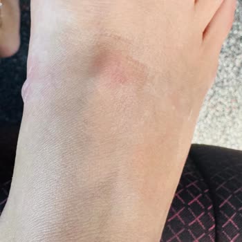 İlk Kullanımda Ayağımı Yaralayan Terlikler Tatilimi Mahvetti