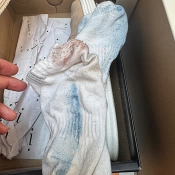 Ayakkabıdan Çoraba Bulaşan Boya Lekesi Ve İade Talebi